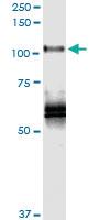 Anti-PLK4 Polyclonal Antibody Pair