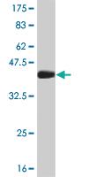 Anti-TGIF2 Mouse Monoclonal Antibody [clone: 5B11]