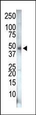 Anti-PIP4K2C Rabbit Polyclonal Antibody (AP (Alkaline Phosphatase))