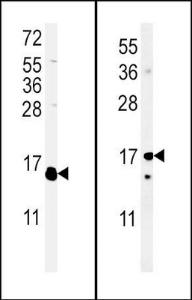 Anti-IL4 Rabbit Polyclonal Antibody