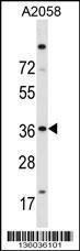 Anti-ISL2 Rabbit Polyclonal Antibody