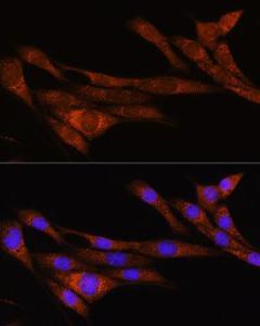 Immunofluorescence analysis of NIH/3T3 cells using Anti-ARHGAP30 Antibody (A308183) at a dilution of 1:100. DAPI was used to stain the cell nuclei (blue)