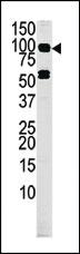 Anti-MARK4 Rabbit Polyclonal Antibody