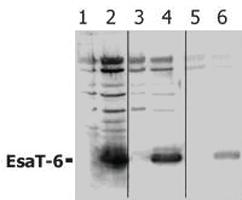 Anti-Mycobacterium tuberculosis EsaT-6 Rabbit Polyclonal Antibody