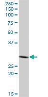 Anti-PHYHD1 Mouse Polyclonal Antibody