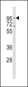 Anti-TFRC Rabbit Polyclonal Antibody (AP (Alkaline Phosphatase))