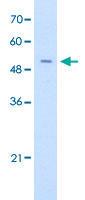 Anti-FECH Rabbit Polyclonal Antibody