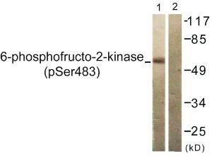 Western blot analysis of lysates from 293 cells treated with Heat shock using Anti-PFKFB2 (phospho Ser483) Antibody. The right hand lane represents a negative control, where the antibody is blocked by the immunising peptide