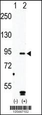 Anti-MARK4 Rabbit Polyclonal Antibody