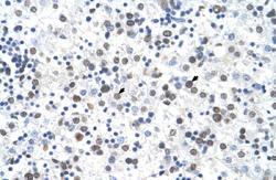 Anti-FECH Rabbit Polyclonal Antibody