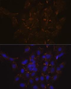 Anti-Scramblase 1 Rabbit Monoclonal Antibody [clone: ARC2028]