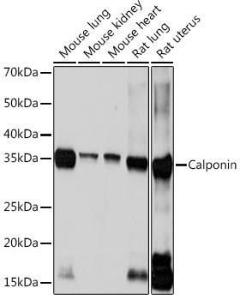 Anti-Calponin 1 Rabbit Monoclonal Antibody [clone: ARC0232]