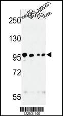 Anti-MASTL Rabbit Polyclonal Antibody