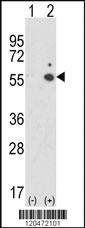 Anti-ICAM1 Rabbit Polyclonal Antibody