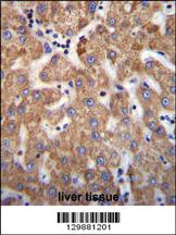 Anti-SOWAHD Rabbit Polyclonal Antibody