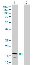 Anti-LY96 Rabbit Polyclonal Antibody