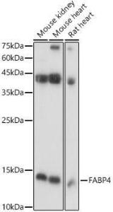 Anti-FABP4 Rabbit Polyclonal Antibody