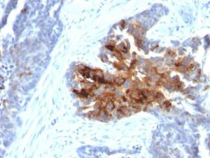 Immunohistochemical analysis of formalin-fixed, paraffin-embedded human ovary using Anti-TAG72 Antibody [CA72/2869R]