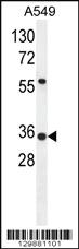 Anti-SOWAHD Rabbit Polyclonal Antibody