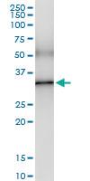 Anti-EXOSC3 Polyclonal Antibody Pair