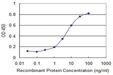 Anti-KCNC3 Mouse Monoclonal Antibody [clone: 6F7]