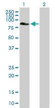 Anti-EPS8L2 Mouse Polyclonal Antibody