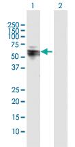 Anti-SARS2 Rabbit Polyclonal Antibody