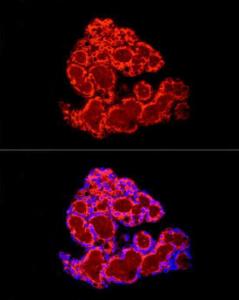 Anti-FABP4 Rabbit Polyclonal Antibody