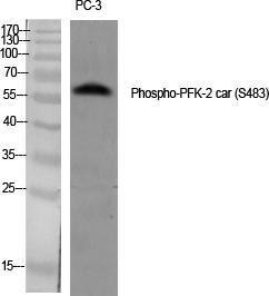 Western blot analysis of various cells using Anti-PFKFB2 (phospho Ser483) Antibody