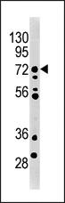 Anti-MELK Rabbit Polyclonal Antibody