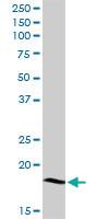 Anti-LY96 Rabbit Polyclonal Antibody