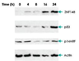 Anti-ZNF148 Rabbit Polyclonal Antibody