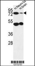 Anti-AVL9 Rabbit Polyclonal Antibody (APC (Allophycocyanin))