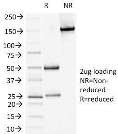 SDS-PAGE analysis of Anti-Desmoglein 1 Antibody [18D4] under non-reduced and reduced conditions; showing intact IgG and intact heavy and light chains, respectively. SDS-PAGE analysis confirms the integrity and purity of the antibody