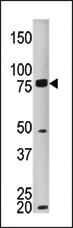 Anti-MELK Rabbit Polyclonal Antibody