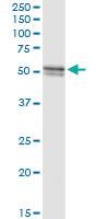 Anti-SARS2 Rabbit Polyclonal Antibody