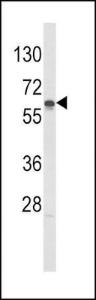 Anti-Hexokinase, Type IV Rabbit Polyclonal Antibody (AP (Alkaline Phosphatase))