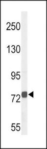 Anti-CHAT Rabbit Polyclonal Antibody