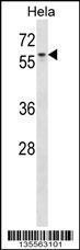 Anti-AGFG1 Rabbit Polyclonal Antibody (HRP (Horseradish Peroxidase))