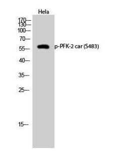 Western blot analysis of Hela cells using Anti-PFKFB2 (phospho Ser483) Antibody