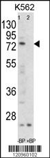 Anti-FLCN Rabbit Polyclonal Antibody