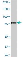 Anti-EPS8L2 Mouse Polyclonal Antibody