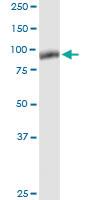 Anti-MCM9 Rabbit Polyclonal Antibody