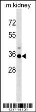 Anti-HOXA3 Rabbit Polyclonal Antibody (PE (Phycoerythrin))