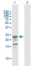 Anti-KCNE1 Mouse Polyclonal Antibody