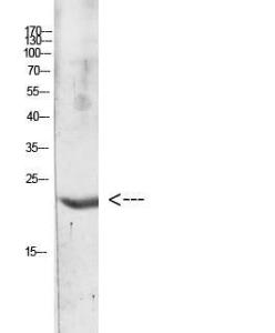 Western blot analysis of Hela Cell Lysate using Anti-IL31 Antibody