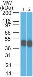 Anti-Cytokeratin 18 antibody