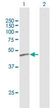 Anti-ERCC8 Mouse Polyclonal Antibody