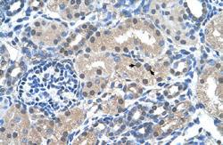 Anti-FKBP6 Rabbit Polyclonal Antibody