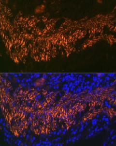 Anti-Calponin 1 Rabbit Monoclonal Antibody [clone: ARC0232]